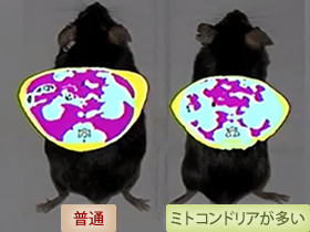 内臓脂肪をご覧下さい!