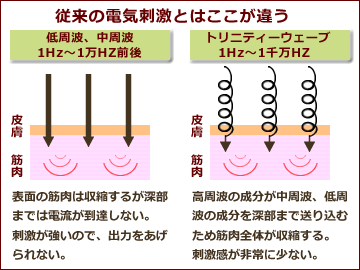 【従来の電気刺激とはここが違う】～【低周波、中周波1Hz～1万Z前後】表面の筋肉は収縮するが深部までは電流が到達しない～【トリニティーウェーブ1Hz～1千万HZ】高周波の成分が中周波、低周波の成分を深部まで送り込むため筋肉全体が収縮する。刺激間が非常に少ない。